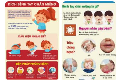Bài tuyên truyền phòng chống bệnh tay, chân, miệng