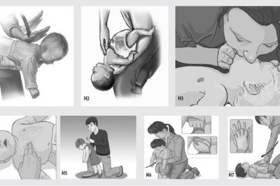 Cách xử trí dị vật đường thở trẻ em