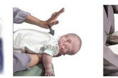 CÁCH PHÒNG TRÁNH VÀ XỬ TRÍ KHI TRẺ BỊ HÓC, SẶC